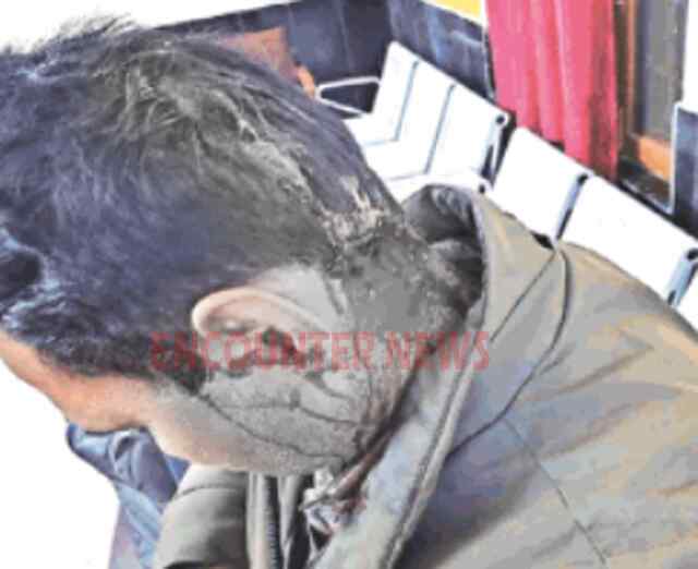 Jalandhar News: ट्रेन के लोको पायलट पर लुटेरों ने तेजधार हथियारों से किया हमला, नगदी पर्स छीनकर फरार