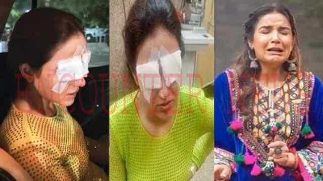 Actress Jasmine Bhasin को दिखना हुआ बंद ! दर्द से घंटों तक रही तड़पती