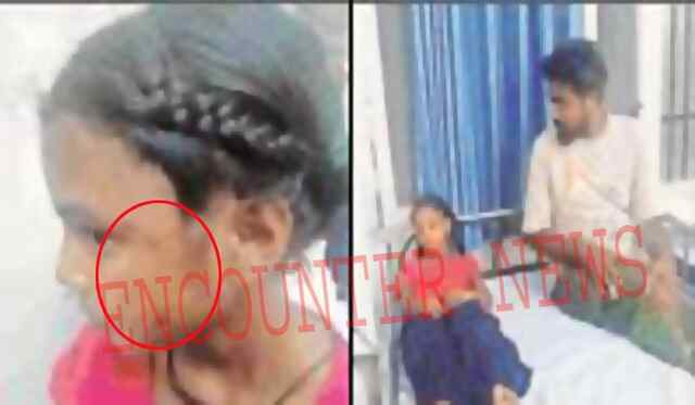 Jalandhar: Homework न करने पर बच्चों को बेरहमी से टीचर ने पीटा, Hospital में भर्ती