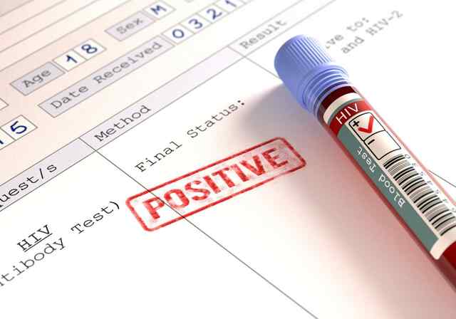 जेल में 125 कैदी मिले HIV पॉजिटव, मचा हड़कंप