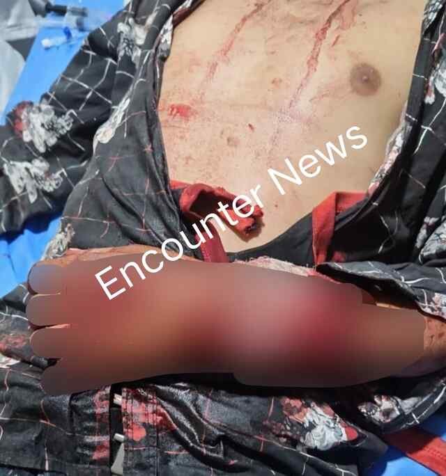 Jalandhar News:  गुंडागर्दी का नंगा नाच, घर के बाहर खड़े युवक पर किया जानलेवा हमला