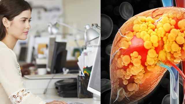 ICMR Study: Desk Job करने वालों को Fatty Liver का ज्यादा खतरा