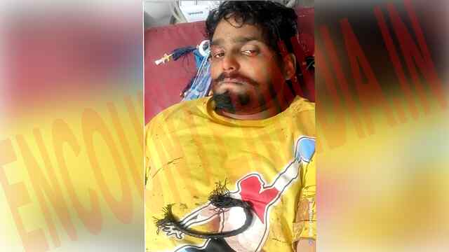 Punjab News: 12वीं के छात्र पर 4 दर्जन नौजवानों ने किया हमला, लगे 50 टांके, देखें वीडियो