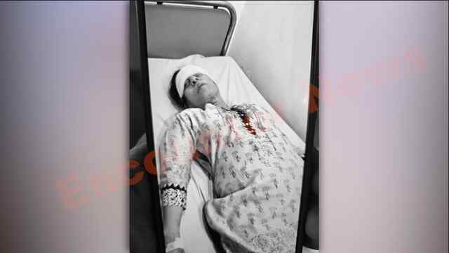 Jalandhar News: आशा क्लीनिक के बाहर डॉक्टर पर तेजधार हथियार से हमला, चेन छीनकर स्नेचर फरार देखें LIVE
