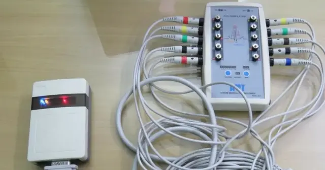 Tele-ECG सेवा दिल के मरीजों को दे रही जीवनदान, ‘गोल्डन ऑवर’ में इलाज से 131 गंभीर मरीजों की बचाई गई जान