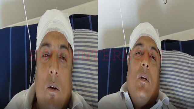 Jalandhar News: रैणक बाजार में 2 पक्षों की झड़प, घायल रॉकी का आया बयान, देखें वीडियो