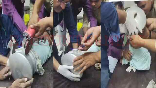 खेलते-खेलते साढ़े 3 वर्षीय बच्चे के सिर में फंसा बर्तन, सांस लेने में होने लगी तकलीफ, देखें वीडियो