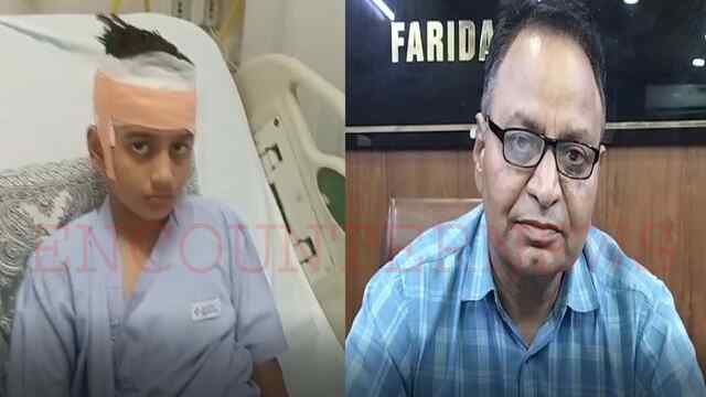 10 वर्षीय मासूम पर आधा दर्जन कुत्तों ने किया हमला, सिर से लेकर पांव तक लगे 50 टांके, देखें वीडियो