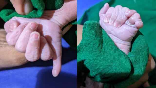 25 अंगुलियों के साथ पैदा हुआ बच्चा, बताया ‘देवी का आशीर्वाद’