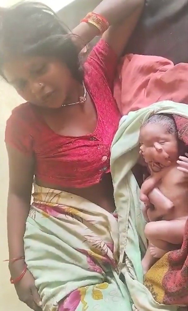 2 मुंह वाले अद्भुत बच्चे को महिला ने दिया जन्म, अस्पताल में लगी भीड़, देखें वीडियो