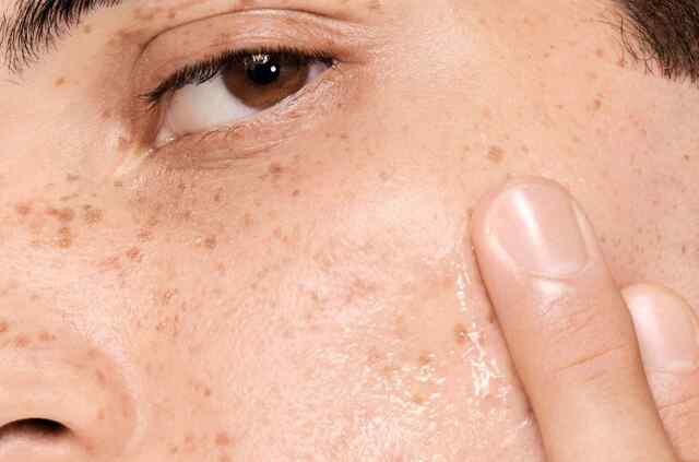 बरसात में चेहरे की चिपचिपाहट से राहत पाने के लिए अपनाएं ये 5 घरेलू Scrub