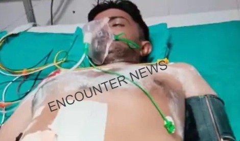 कोर्ट में पेशी पर आए युवक पर हमला, जाने मामला