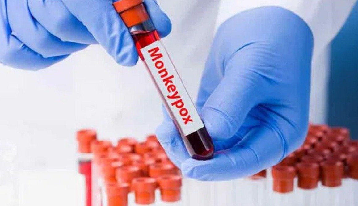 Mpox को लेकर बढ़ता खौफ! राज्य सरकारों के लिए एडवाइजरी जारी