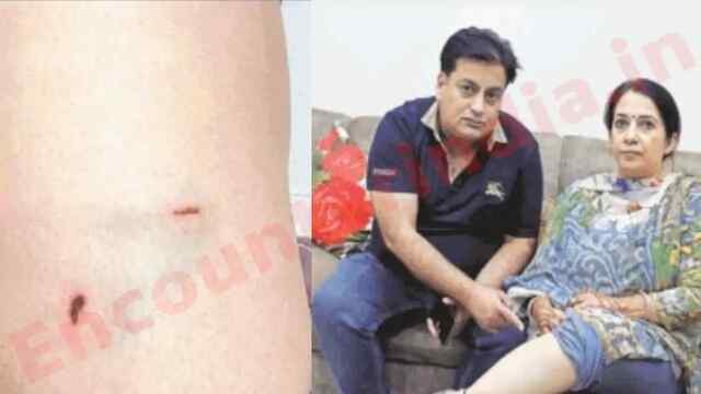 Jalandhar News : आवारा कुत्तों का आतंक, महिला को बुरी तरह नोंचा