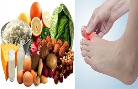 Uric Acid से छुटकारा पाने के लिए खाएं ये चीजें, देखें वीडियो