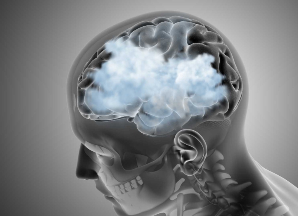 चीजें भूलना या काम में मन ना लगना हो सकते हैं Brain Fog के लक्षण