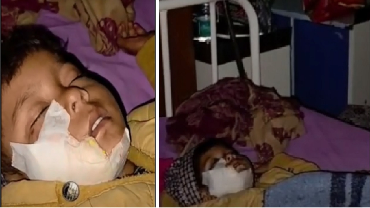 सियार का आतंकः 3 साल की बच्ची पर हमला कर नोचा गाल