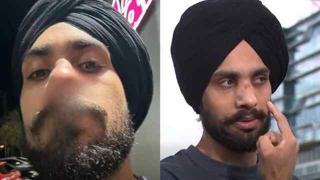 Australia में सिख युवक पर नस्लीय हमला, 3 हमलावरों ने नाक तोड़ी