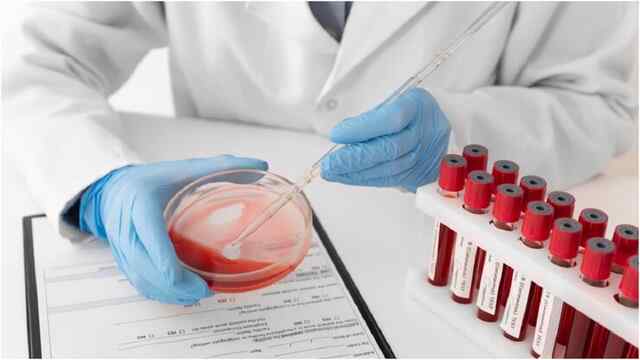 दुनियाभर के वैज्ञानिक हैरान, भारत में मिला दुर्लभ Blood Group