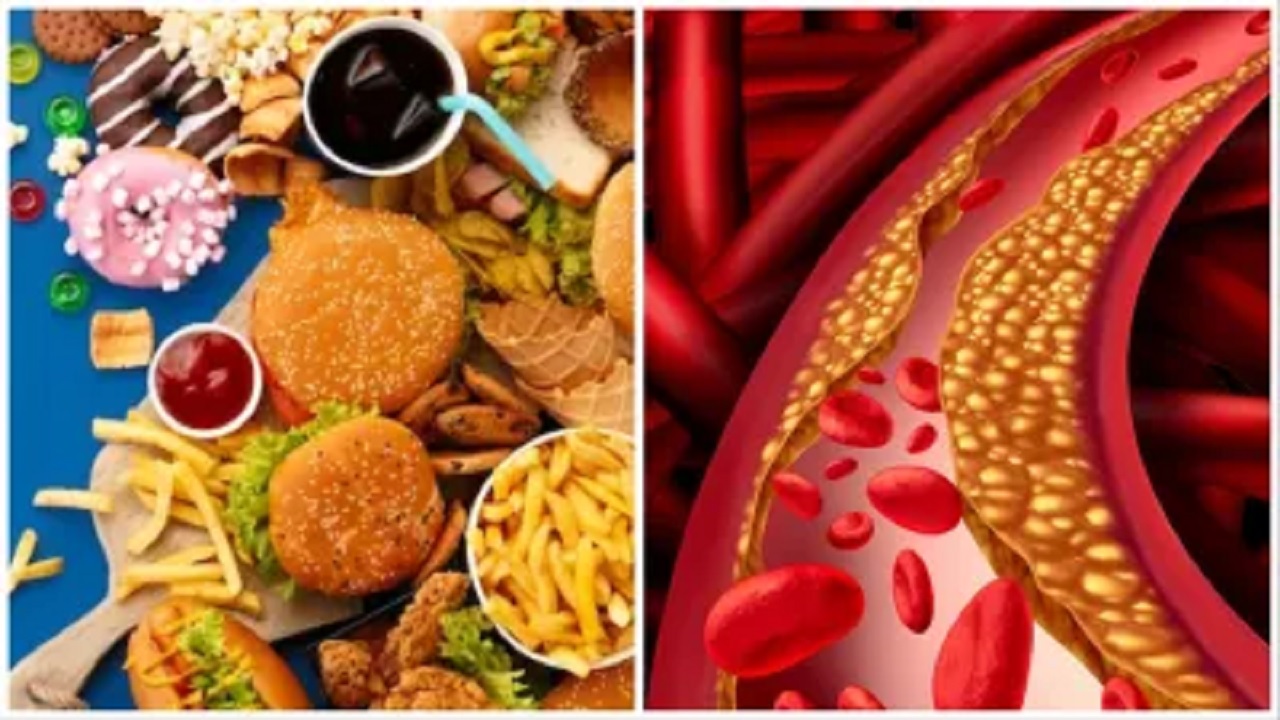 Unhealthy Lifestyle से High Cholesterol की समस्या आम, ये नुस्खा आएगा काम