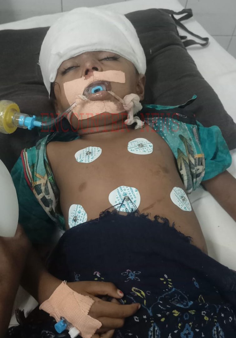 Punjab News: सीढ़ियों से गिरने से 4 वर्षीय मासूम की हालत बिगड़ी, मां वेटिलेंटर ऑक्सीजन का करती रही इंतजार