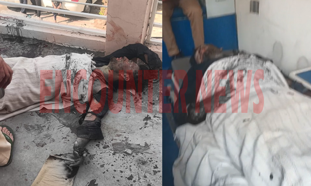 Punjab News: पोटाश Gun में बारूद भरने के दौरान हुए धमाके में युवक के दोनों हाथों की कटी हथेलियां