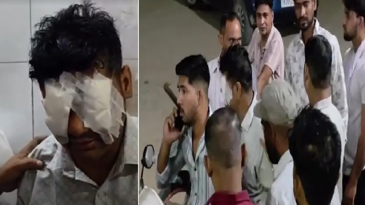 Birthday पर पटाखा चलाना पड़ा महंगा, दोनों आंखें झुलसी