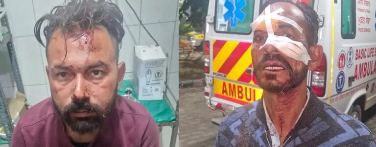 Punjab News: रेहड़ी लगाने को लेकर 2 पक्ष हुए आमने सामने, व्यक्ति के चेहरे पर फैंका गर्म तेल