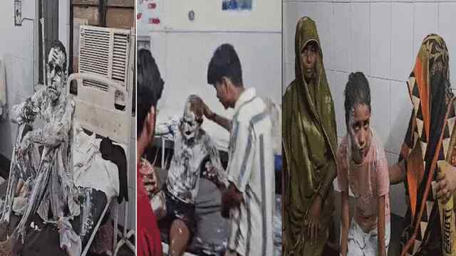 Cylinder लीक होने से घर में लगी भीषण आग, 14 लोग घायल, मचा हड़कंप