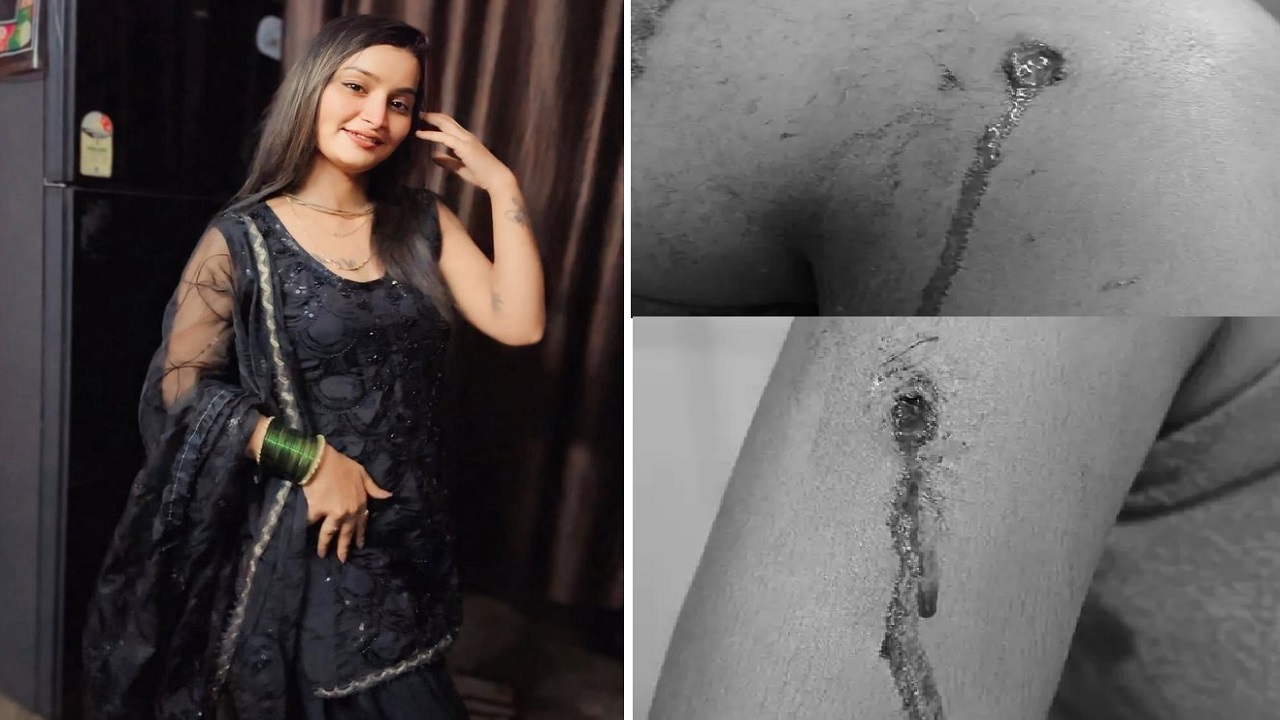 सिरफिरे प्रेमी ने प्रेमिका को मारी गोली, रात को घर में घुसकर दिया वारदात को अंजाम