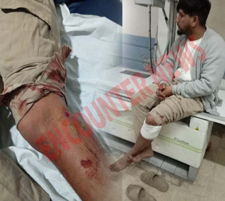 Jalandhar News: इस इलाके में बदमाशों ने घर में घुसकर युवक पर चलाई गोलियां, घायल