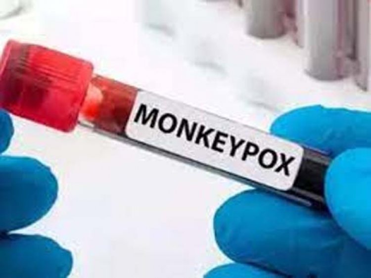 भारत में मंकीपॉक्स से हुई पहली मौत, 22 साल के युवक ने तोड़ा दम