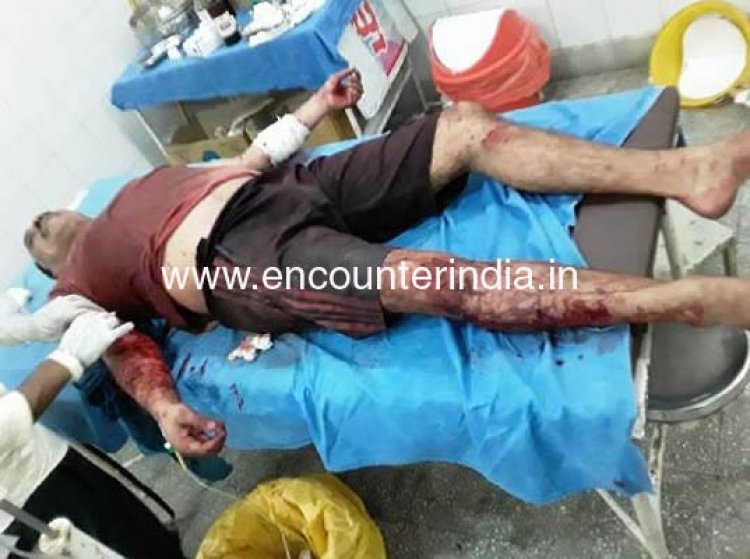 पंजाबः पिटबुल ने पुलिसकर्मी को किया जख्मी, हालत नाजुक होने पर डॉक्टरों ने चंडीगढ़ किया रेफर 