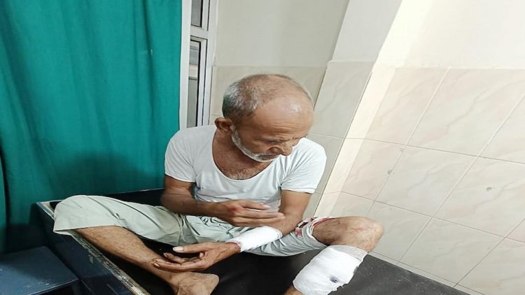 सैर के लिए निकले बुजुर्ग पर आवारा कुत्ते ने किया हमला 