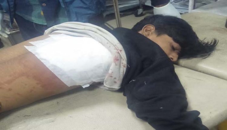 8वीं के छात्र को मारी गोली, 13 के खिलाफ मामला दर्ज