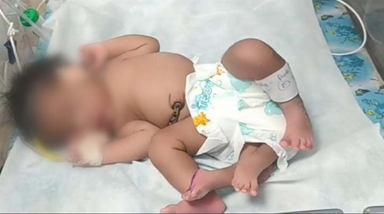 महिला ने दिया 4 पैर वाली बच्ची को जन्म, देखने के लिए उमड़ी लोगों की भीड़