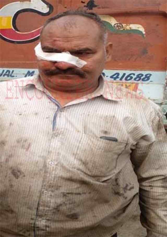 जालंधरः चाइना डोर से हुआ व्यक्ति घायल, बाल-बाल बची आंख
