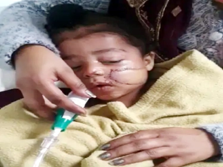 पंजाब : प्लास्टिक डोर की चपेट में आया 4 वर्षीय बच्चा, चेहरे पर लगे 120 टांके