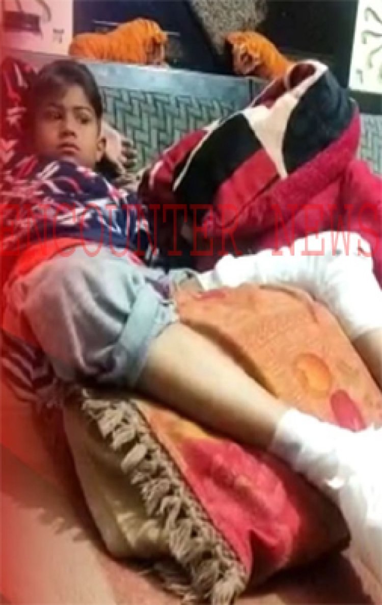 चाइना डोर में करंट आने से बुरी तरह झुलसा 10 वर्षीय बच्चा