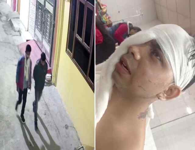 घर में घुसकर मां-बेटे पर एसिड अटैक, CCTV में आरोपी कैद