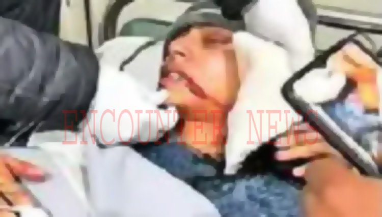 चाइना डोर से सॉफ्टबॉल खिलाड़ी का कटा जबड़ा, लगे 39 टांके