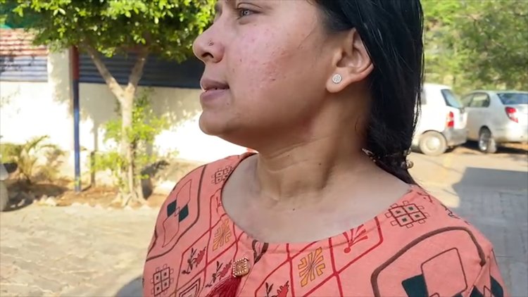 सन्नी हाइट्स में सोने की चेन छीनकर महिला फरार, देखें वीडियो