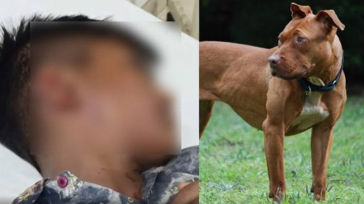 9 साल के बच्चे पर पिटबुल ने किया हमला, हालत नाजुक