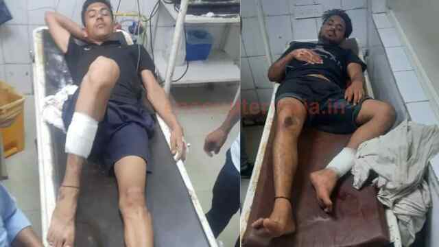 पुलिस और बदमाशों के चली गोलियां, 2 घायल