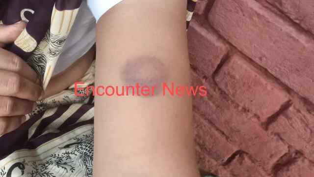 देवर पर लगे भाभी से दुष्कर्म करने के आरोप, मामला दर्ज, देखें वीडियो