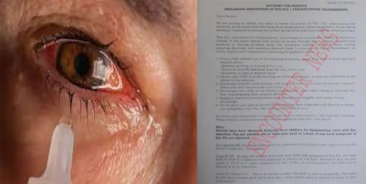 Eye Flu को लेकर स्कूलों में एडवाइजरी जारी