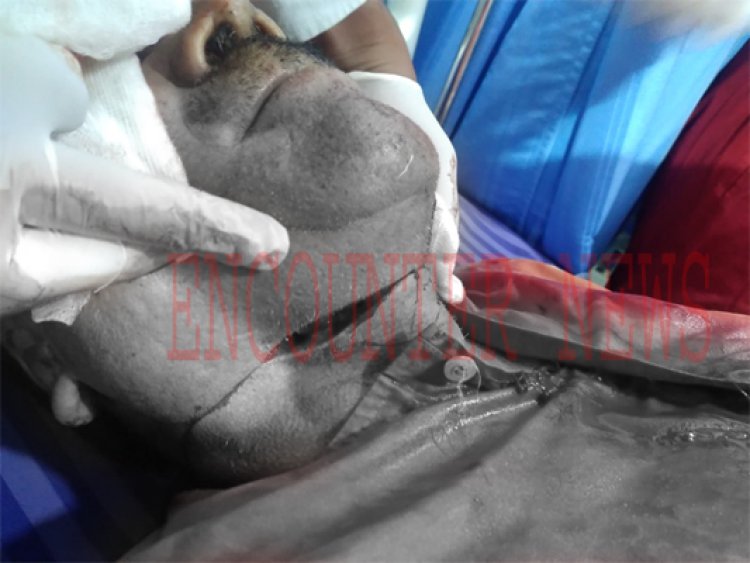 जालंधरः हमलावारों ने स्कूल में घुसकर प्रिंसिपल पर तेजधार हथियार से किया हमला, काटा कान