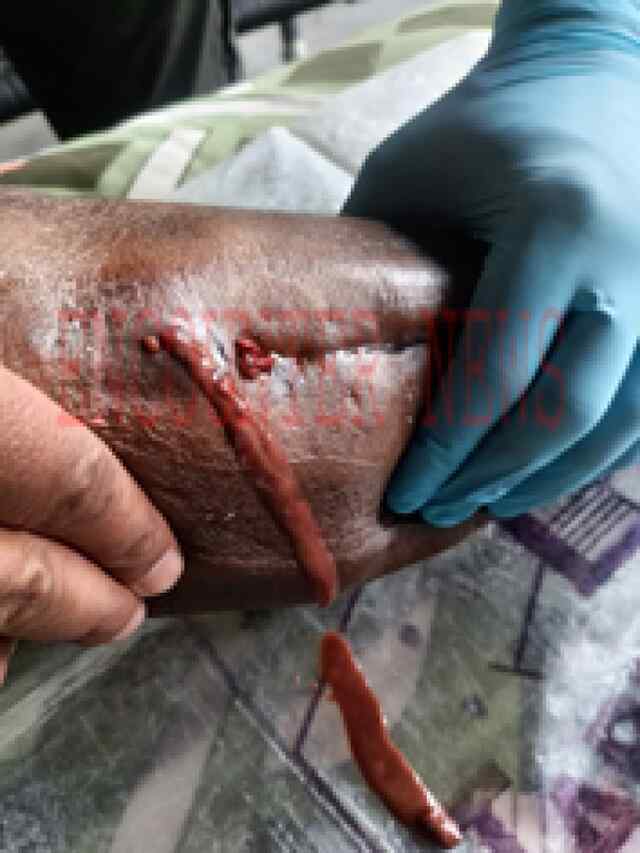 जालंधरः Ganga Hospital में डॉक्टर पर लगे गलत ऑपरेशन करने के आरोप, हुआ हंगामा, देखें Live