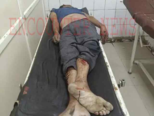 फ्लाईओवर के नीचे व्यक्ति का श+व हुआ बरामद