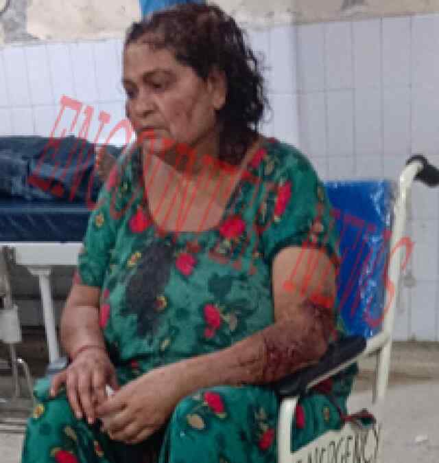 जालंधरः नहीं थम रहा पिटबुल का कहर, महिला को बुरी तरह से नोचा 